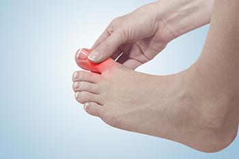 Various Reasons for Toe Pain