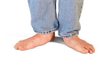 Causes of Adult Acquired Flat Feet
